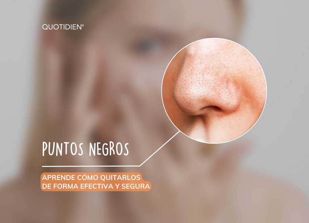 Cómo quitar puntos negros de la cara de forma efectiva y segura
