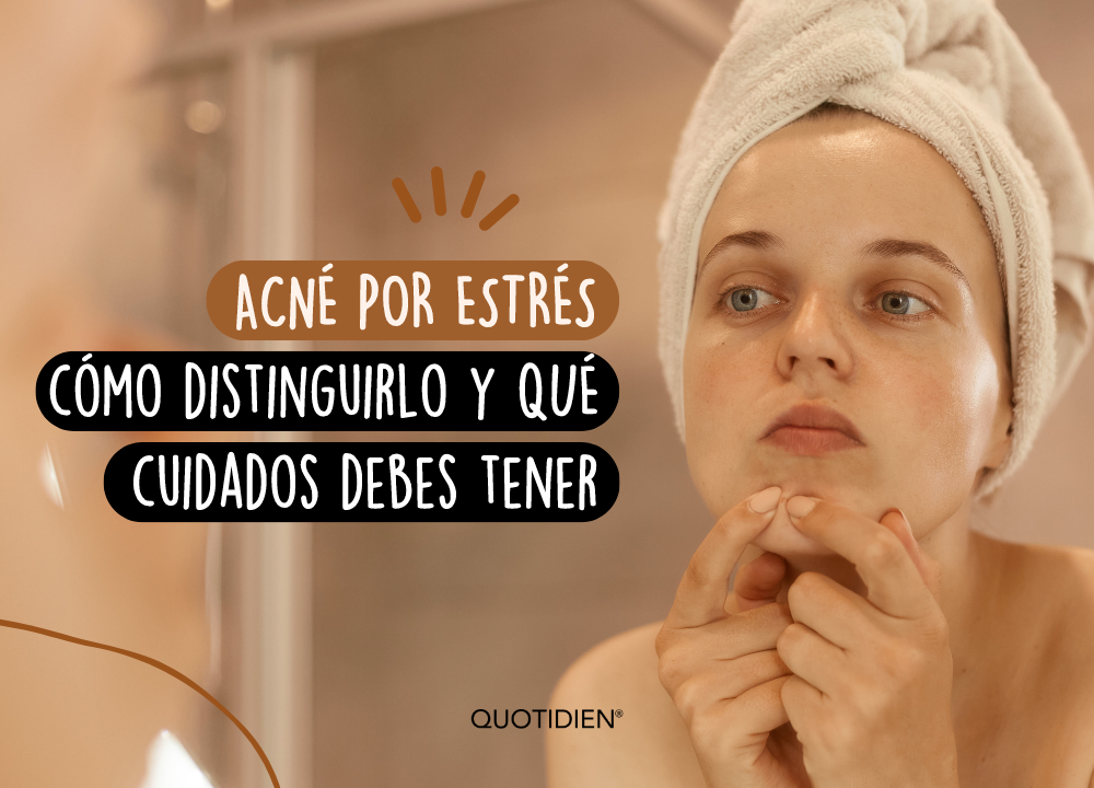 Acne por estres: cómo distinguirlo y qué cuidados debes tener