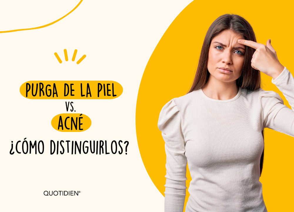 Purga de la piel vs. acné: cómo distinguirlos y saber si es positivo