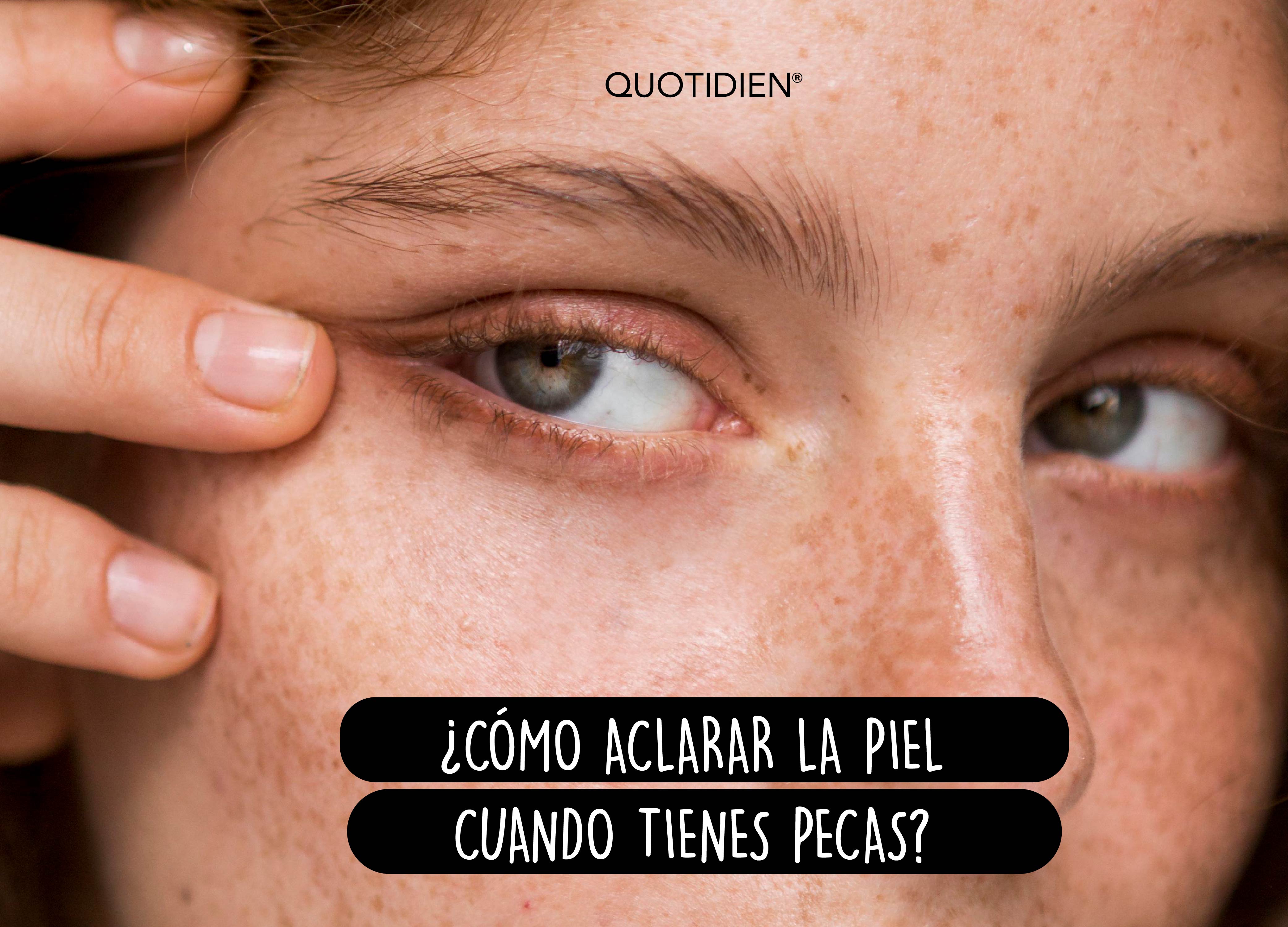 ¿Cómo aclarar la piel y quitar pecas de la cara?