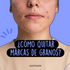 ¿Cómo quitar marcas de granos y disfrutar de una piel sin cicatrices?