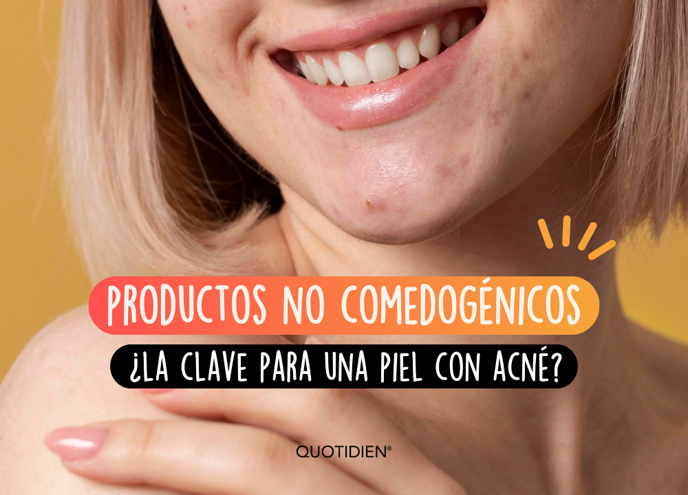 Productos no comedogénicos: ¿la clave para una piel con acné?