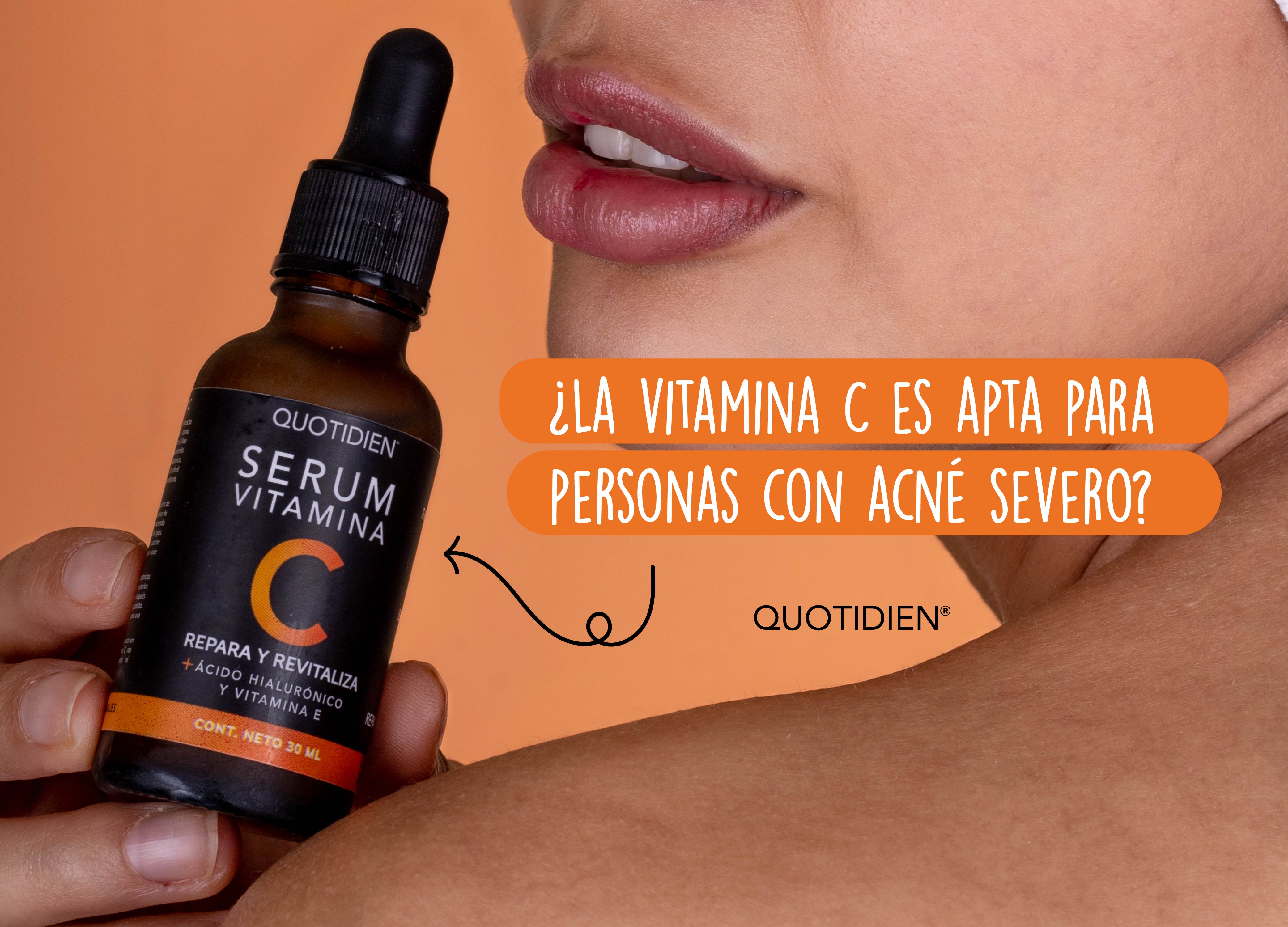 Vitamina C para el acné severo: ¿es seguro?