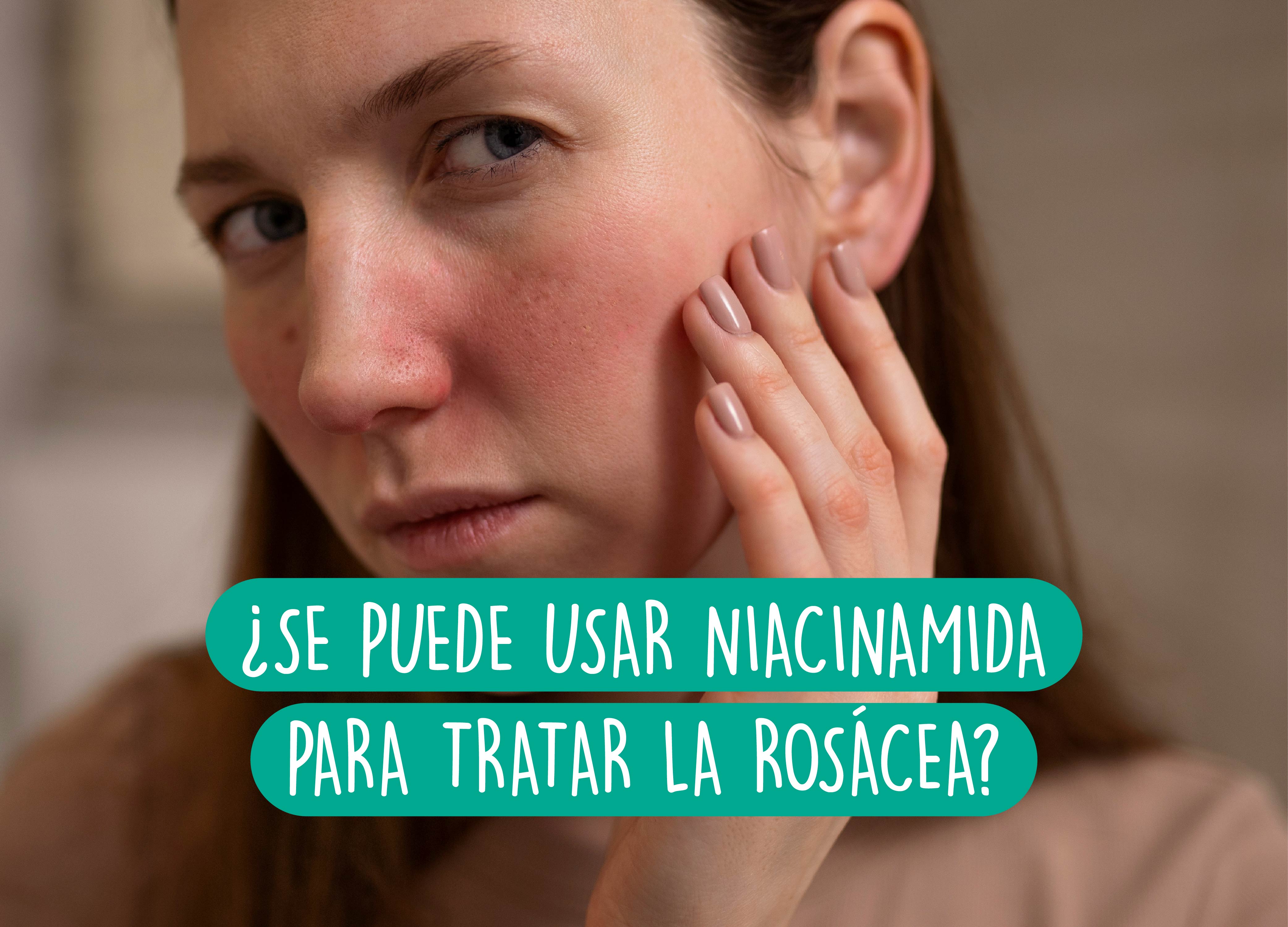 Niacinamida para rosacea: ¿se puede usar?